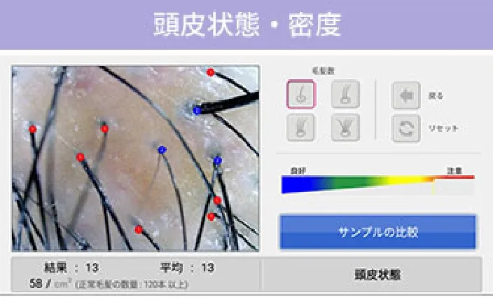 頭皮状態・密度